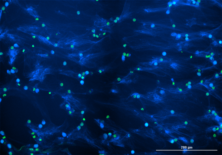 PMA induces NET formation in human neutrophils