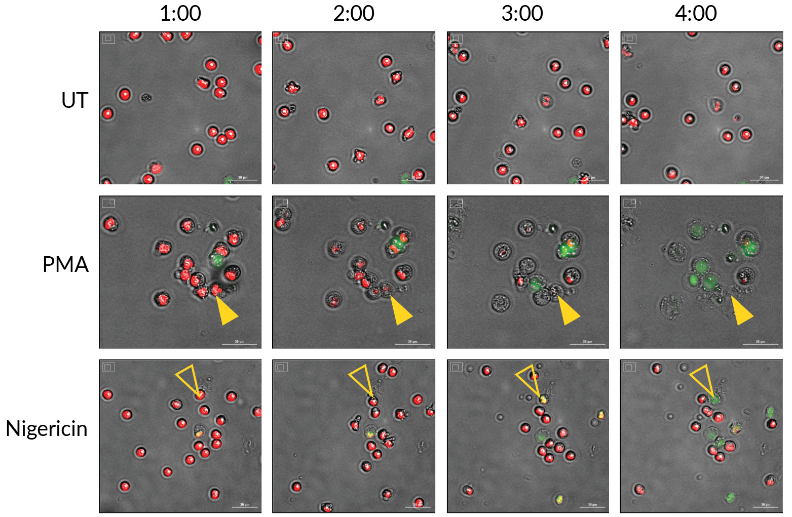 Monitoring the morphology of primary human neutrophils undergoing NETosis