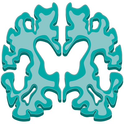 TNF α Targeted Therapies in Alzheimers Disease