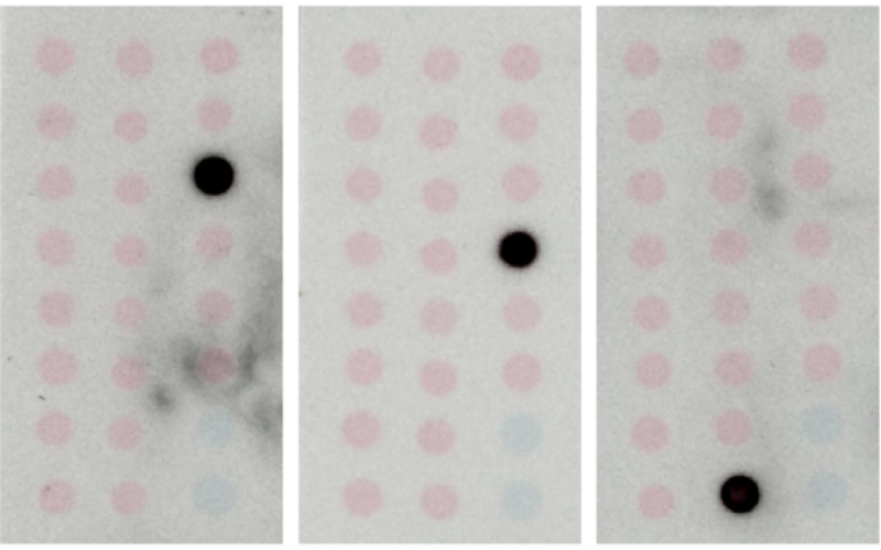 ghk cu injection before and after pictures GHK-Cu before and after : r/Biohackers ghk cu injection before and after pictures GHK-Cu before and after : r/Biohackers