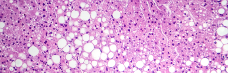 Wy 14643 (NSC 310038, Pirinixic Acid, CAS Number: 50892-23-4