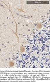 Optineurin (C-Term) Polyclonal Antibody