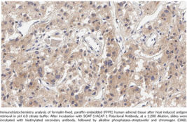 SOAT-1/ACAT-1 Polyclonal Antibody