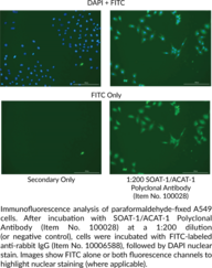 SOAT-1/ACAT-1 Polyclonal Antibody