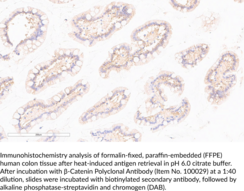 β-Catenin Polyclonal Antibody