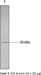 Monoacylglycerol Lipase Polyclonal Antibody (HU-K5, Lysophospholipase homolog, MAGL, MGL, MGLL)