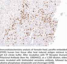 TP Receptor (human) Polyclonal Antibody