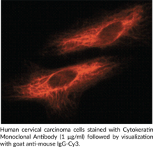 Cytokeratin Monoclonal Antibody (Clone C-11) (CKs, pan-Cytokeratin, Keratin)