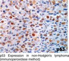 p53 Monoclonal Antibody (Clone BP53-12)