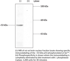 p53 (Phospho-Ser392) Polyclonal Antibody (Antigen NY-CO-13, Cellular Tumor Antigen p53, Phosphoprotein p53, Transformation-related Protein 53, Tumor Protein p53, Tumor Suppressor p53)