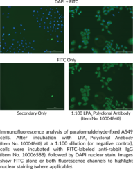LPA3 Polyclonal Antibody