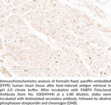 FABP4 Polyclonal Antibody