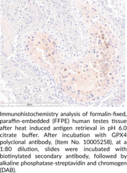 GPX4 Polyclonal Antibody (Glutathione Peroxidase 4, PhGPx, Phospholipid  Hydroperoxide Glutathione Peroxidase)