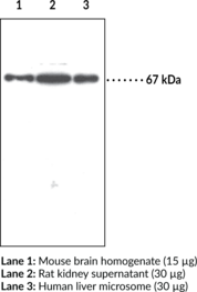 Serine Palmitoyltransferase Polyclonal Antibody (Long Chain Biosynthesis Protein 2 (LCB2), Serine-palmitoyl-CoA transferase 2 (SPT2))