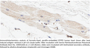 Serine Palmitoyltransferase Polyclonal Antibody