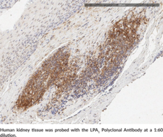 LPA1 Polyclonal Antibody