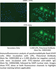 LPA1 Polyclonal Antibody
