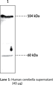 Autotaxin Polyclonal Antibody (ENPP2, Lysophospholipase D, Lyso-PLD)