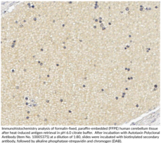 Autotaxin Polyclonal Antibody (ENPP2, Lysophospholipase D, Lyso