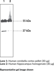 Melanocortin-4 Receptor Polyclonal Antibody (MC4R)