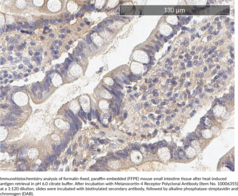 Melanocortin-4 Receptor Polyclonal Antibody