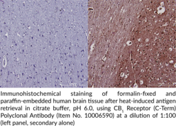 CB1 Receptor (C-Term) Polyclonal Antibody