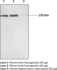 PH Domain Leucine-rich Repeat Protein Phosphatase 1 Polyclonal Antibody (KIAA0606, PHLPP1, PLEKHE1, Pleckstrin Homology Domain-containing Family E Member 1, hSCOP, Suprachiasmatic Nucleus Circadian Oscillatory Protein)