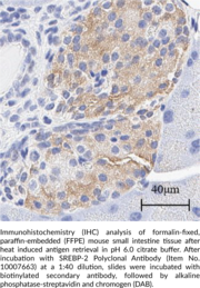 SREBP-2 Polyclonal Antibody