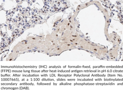 LDL Receptor Polyclonal Antibody