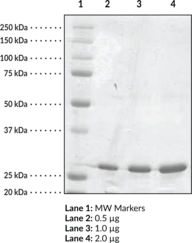 Serum Retinol Binding Protein 4 (human recombinant) (RBP4, sRBP4)