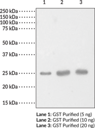 how much oral glutathione per day Glutathione S-transferase | Inhibitors