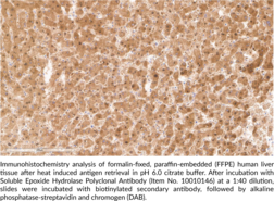 Soluble Epoxide Hydrolase Polyclonal Antibody (Cytosolic Epoxide Hydrolase (CEH), EPHX2, Epoxide Hydrolase 2, sEH)
