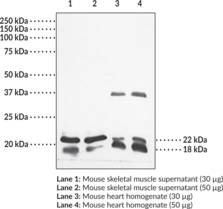 Caveolin-1/3 Polyclonal Antiserum (Cav-1/3)