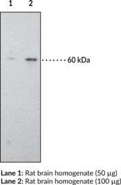 CB1 Receptor Polyclonal Antibody (Cannabinoid Receptor 1, CNR1)