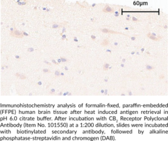 CB2 Receptor Polyclonal Antibody