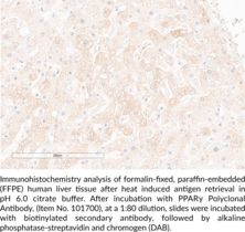 PPARγ Polyclonal Antibody