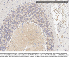 PPARδ Polyclonal Antibody