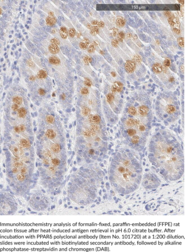 PPARδ Polyclonal Antibody