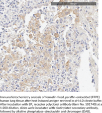 EP1 Receptor Polyclonal Antibody