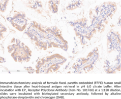 EP3 Receptor Polyclonal Antibody