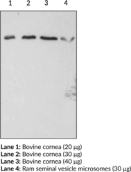 FP Receptor Polyclonal Antibody (PGF2α Receptor, Prostaglandin F2α Receptor)