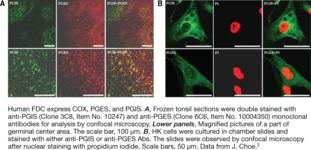Prostaglandin I Synthase Monoclonal Antibody (Clone 3C8) (PGIS, Prostacyclin Synthase)