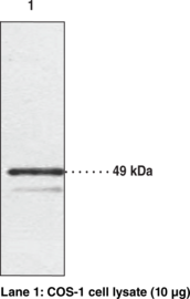 Chemokine-Like Receptor 1 Polyclonal Antibody (CMKLR1, DEZ, GPCR ChemR23, Resolvin E1 Receptor)