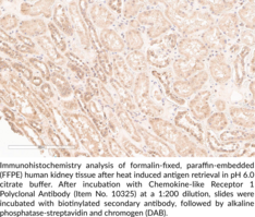 Chemokine-Like Receptor 1 Polyclonal Antibody