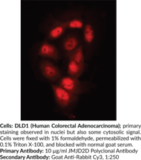 JMJD2D Polyclonal Antibody