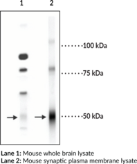 GABAA Receptor δ subunit (N-Term) Polyclonal Antibody (γ-Aminobutyric Acid A Receptor)