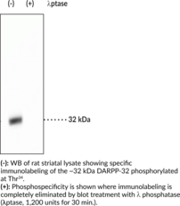 DARPP-32 (Phospho-Thr34) Polyclonal Antibody