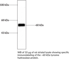 Tyrosine Hydroxylase (rat, denatured) Polyclonal Antibody (TH, Tyrosine 3-hydroxylase, Tyrosine 3-monooxygenase)