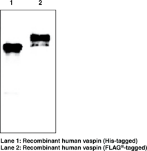 Vaspin (human) Monoclonal Antibody (Clone VP63) (OL-64, Serpin A12, Visceral Adipose Tissue-Derived Serine Protease Inhibitor)