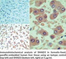 SMAD3 Polyclonal Antibody
